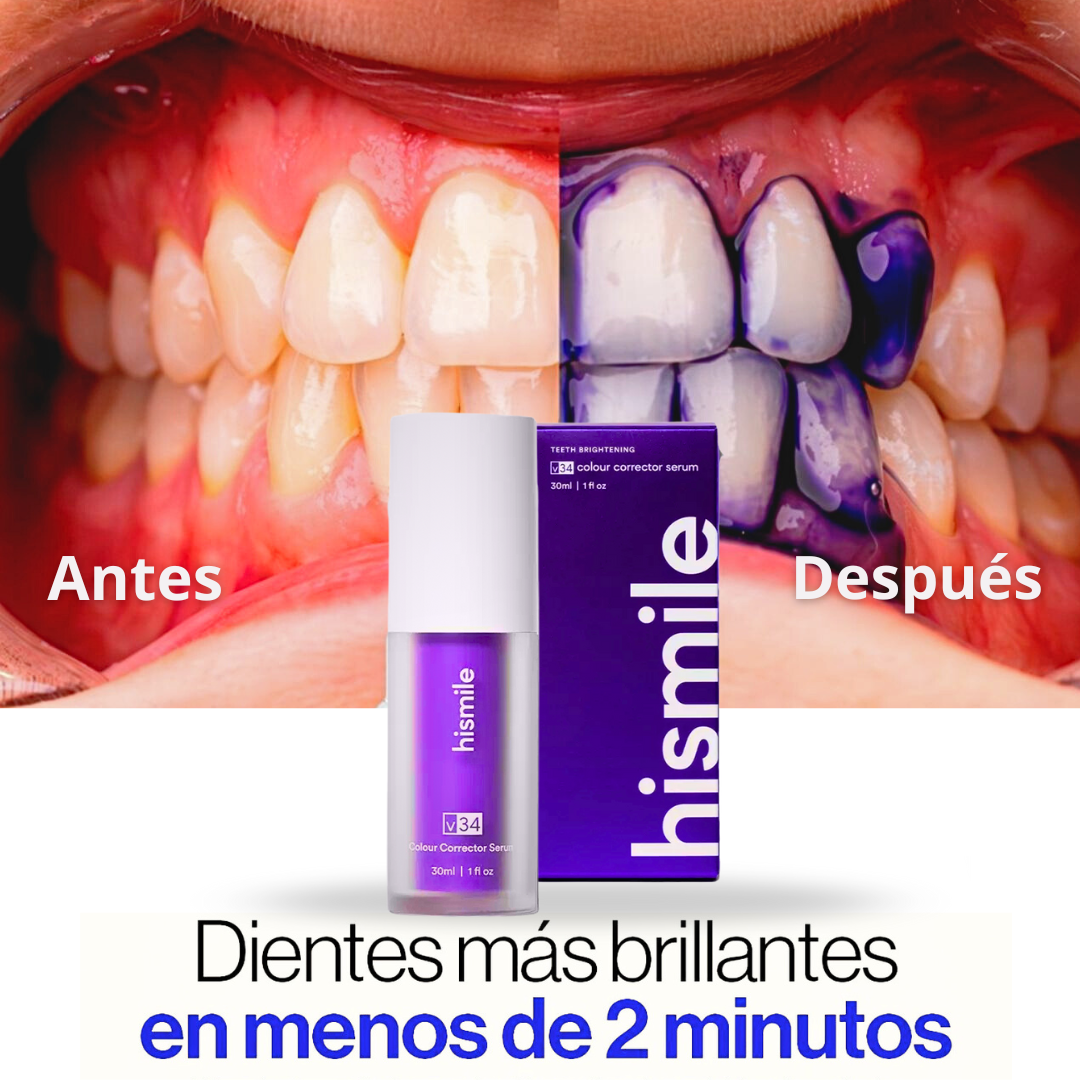 Blanqueamiento Dental Instantáneo V34™ | PROMO 2x1 – ¡DOBLE PRODUCTO, MISMO PRECIO!