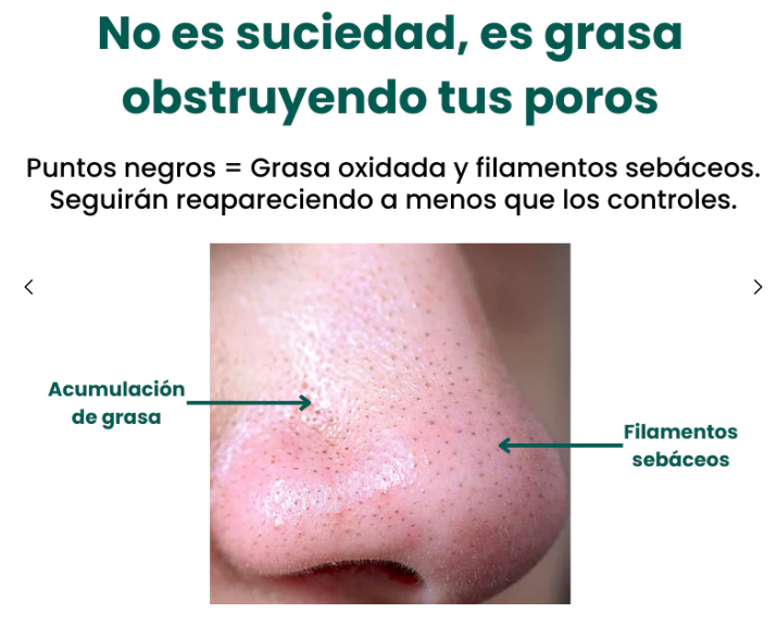 Limpiador Facial de Micro Burbujas – Piel Limpia, Suave y Radiante en Minutos