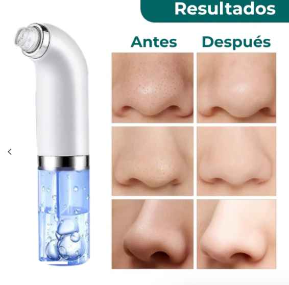 Limpiador Facial de Micro Burbujas – Piel Limpia, Suave y Radiante en Minutos